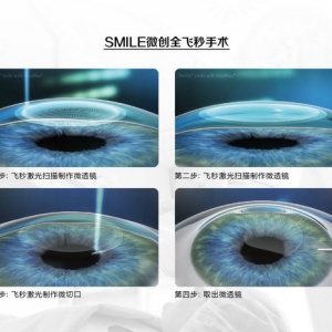 高考后在重庆做近视手术，如何选择手术方式？重庆近视手术专家汪红来揭秘！